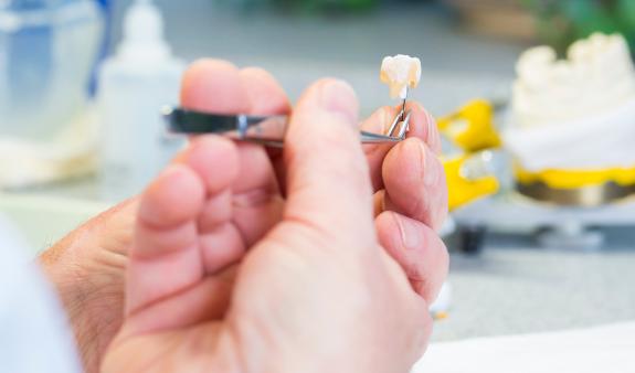 Person im Zahnlabor hält ein Kronemodell in Arbeit